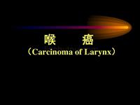 喉癌和喉咽癌（Carcinoma of Larynx）