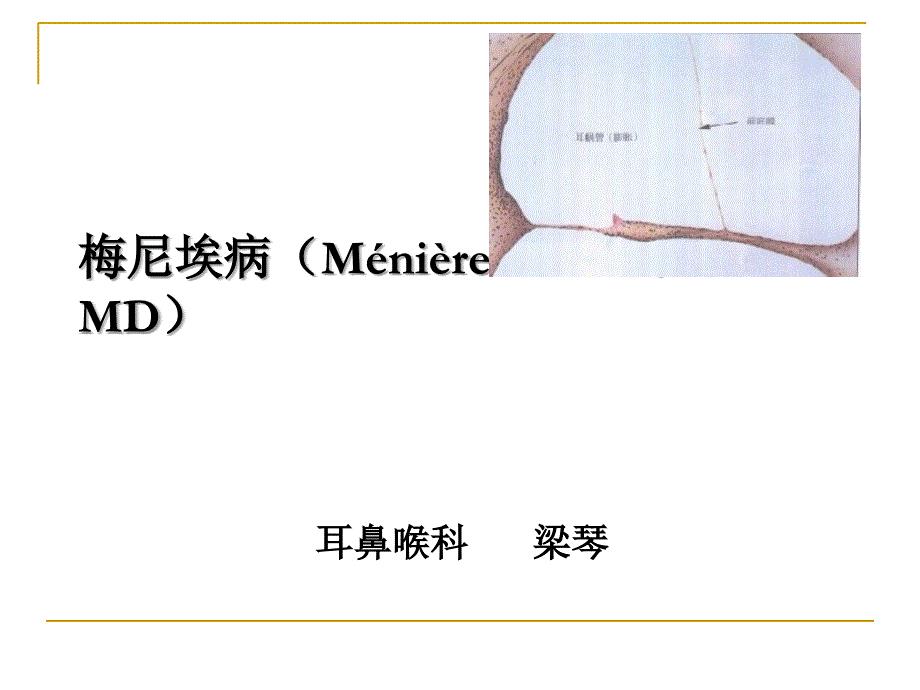 梅尼埃病Ménière disease，MD）梁琴－耳鼻喉科