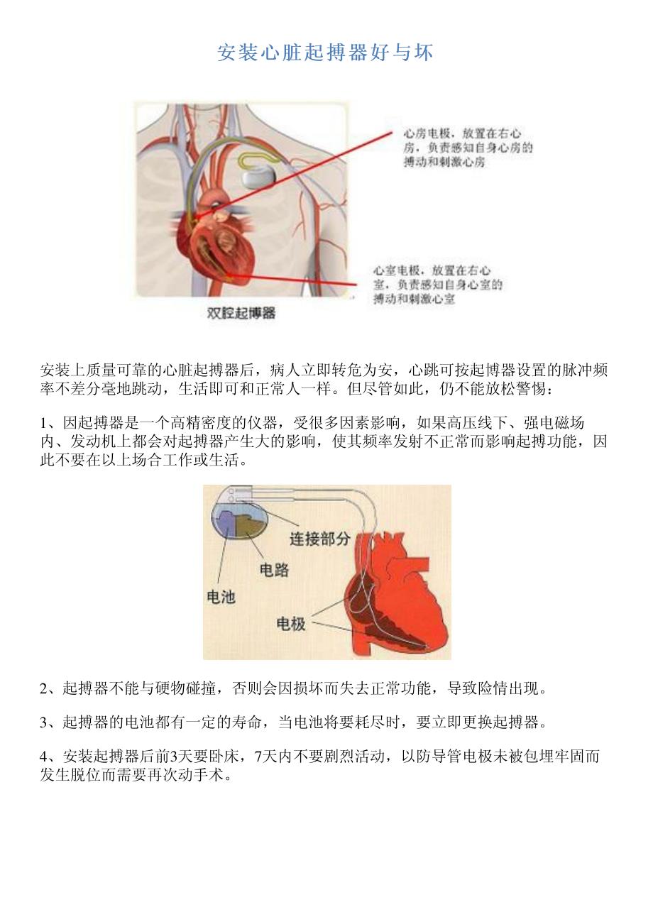 安装心脏起搏器好与坏