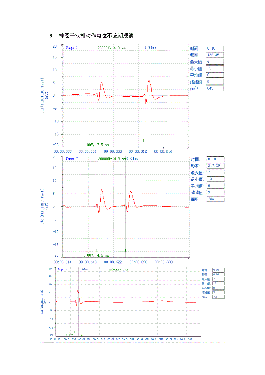 蛙坐骨神经干动作电位实验报告